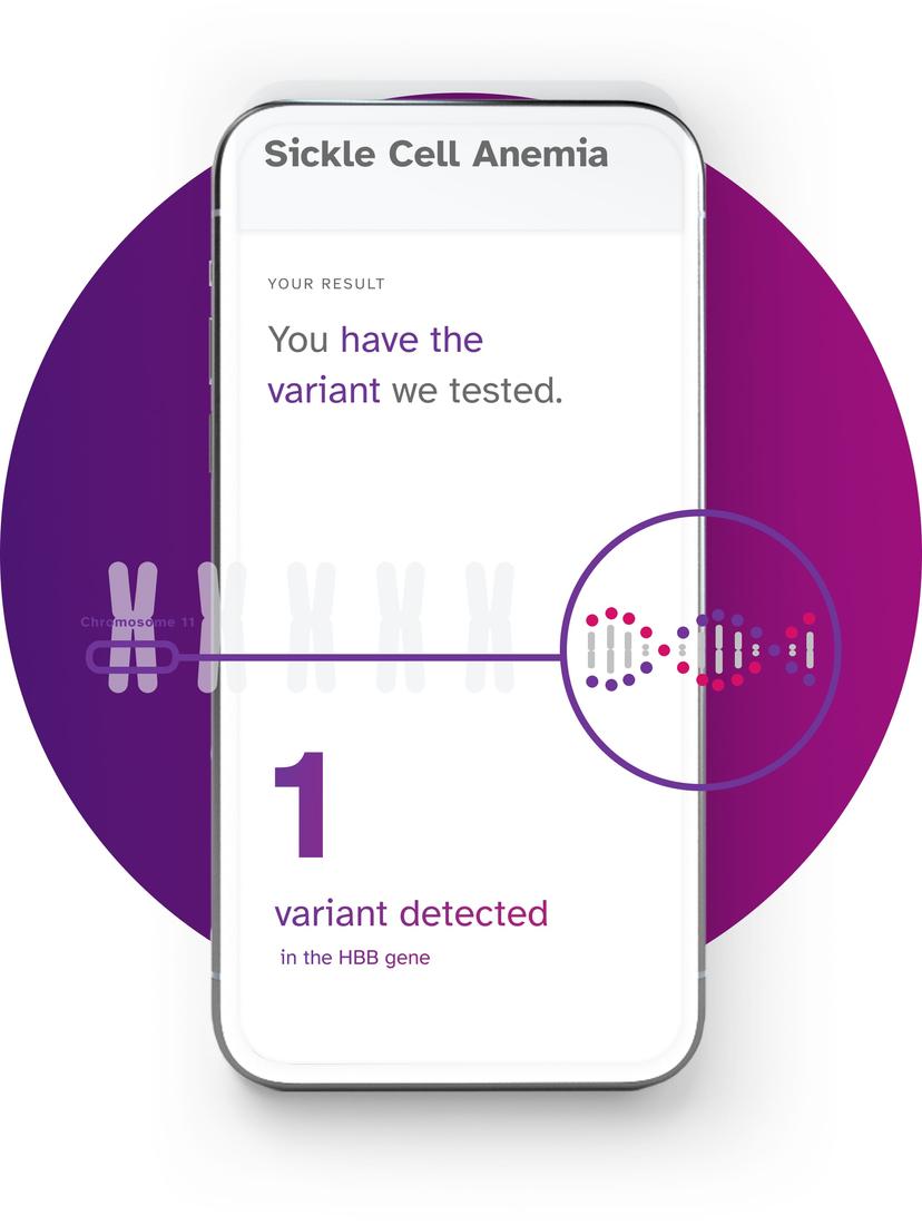 Sickle Cell Anemia report example showing 1 variant detected