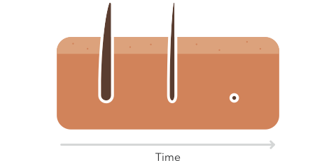 hair follicles