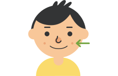 child with cheek dimples