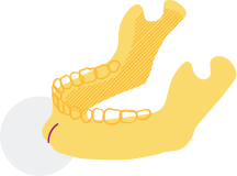 chin bone