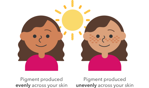even versus uneven pigment on skin