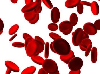 New Research on Sickle Cell Trait