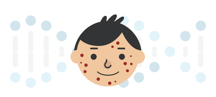 New 23andMe+ Premium Report on Severe Acne
