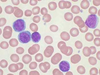 cll