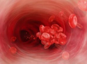 Blood cells clotting