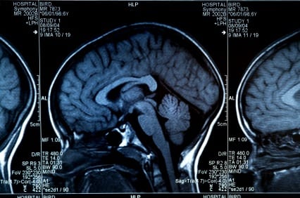 mri