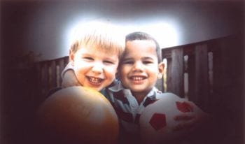 Glaucoma Glaucoma