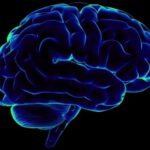 alzheimers