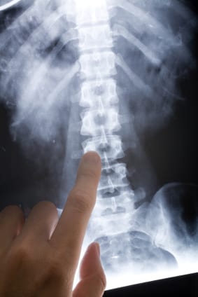 x-ray image
