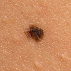 Mole